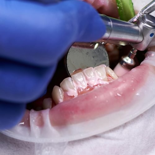 Doctor cleaning and polishing patient teeth in dental clinic.